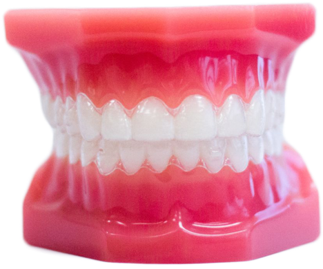 invisalign aligners on plastic model